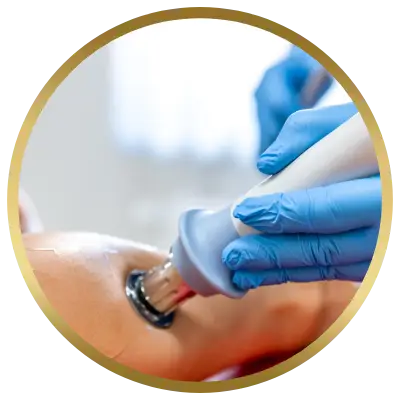 Ello Clínica Dermatologia Rio de Janeiro - Angiologista - Laser para tratamento de vasos
