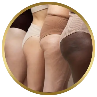 Ello Clínica Dermatologia Rio de Janeiro - Angiologista - Tratamento de lipedema