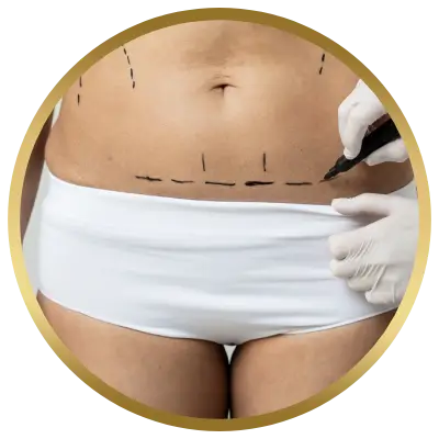 Ello Clínica Dermatologia Rio de Janeiro - Cirurgia Plástica Abdome Barriga