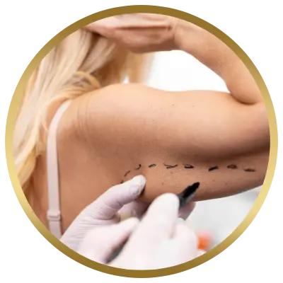 Ello Clínica Dermatologia Rio de Janeiro - Cirurgia Plástica Braquioplastia
