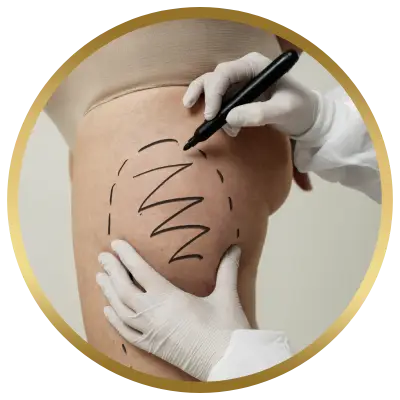 Ello Clínica Dermatologia Rio de Janeiro - Cirurgia Plástica Curoplastia