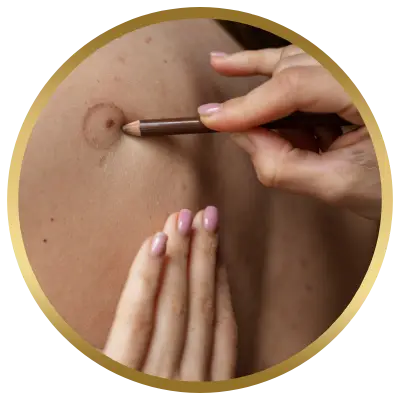 Ello Clínica Dermatologia Rio de Janeiro - Cirurgia Plástica Pequenas Cirurgias