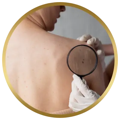 Ello Clínica Dermatologia Rio de Janeiro - Cirurgia Plástica lesões e reconstruções de pele
