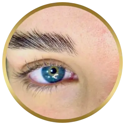 Ello Clínica Dermatologia Rio de Janeiro - Estética Brow lamination