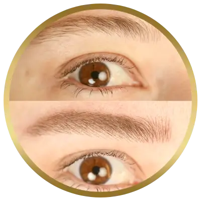Ello Clínica Dermatologia Rio de Janeiro - Esteticista - Nano Fios