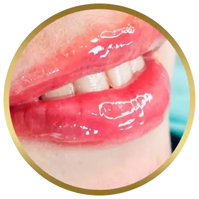 Ello Clínica Dermatologia Rio de Janeiro - Esteticista - Revitalização labial