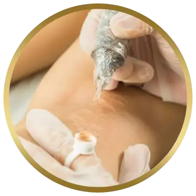 Ello Clínica Dermatologia Rio de Janeiro - Estetica Barra da Tijuca - Camuflagem de estreias, cicatrizes e manchas
