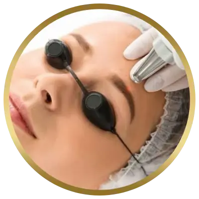 Ello Clínica Dermatologia Rio de Janeiro - Estetica Barra da Tijuca - Remoção a laser
