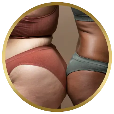 Ello Clínica Dermatologia Rio de Janeiro - Nutrologia - tratamento para lipedema